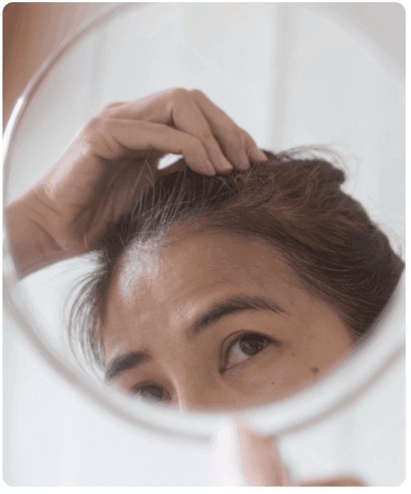 Understanding Hair Loss